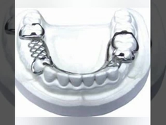 Système de balayage intraoral dentaire dentaire de représentation du pont 3D Digital du laboratoire PFM de dentier