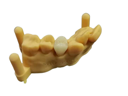 OEM 3D imprimant la conception dentaire de Digital de laboratoire de dentier acrylique flexible