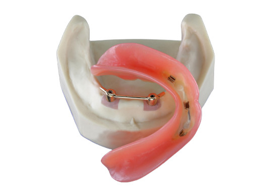 Implant dentaire de sécurité de laboratoire de haut dentier inter biologique de miscibilité