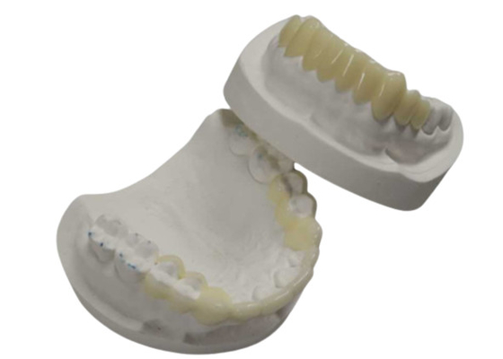 Haute durabilité DAO CAM impression 3D temporaire couronne la résine durable
