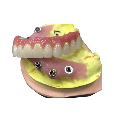 Couronne dentaire de zircone de butée d'implant naturelle tout sur quatre dentiers