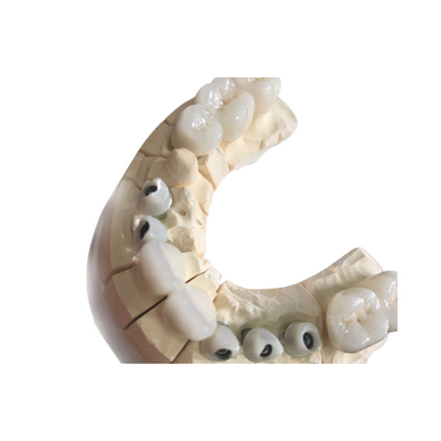 Couronnes dentaires excellent Biocompatibility de zircone blanche libre en métal