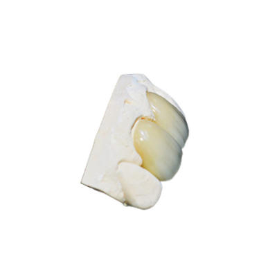 Forme faite sur commande mince de pleine couronne en céramique durable de zircone belle