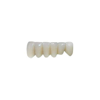 Des couronnes dentaires en zirconium personnalisées Excellente esthétique Matériau durable
