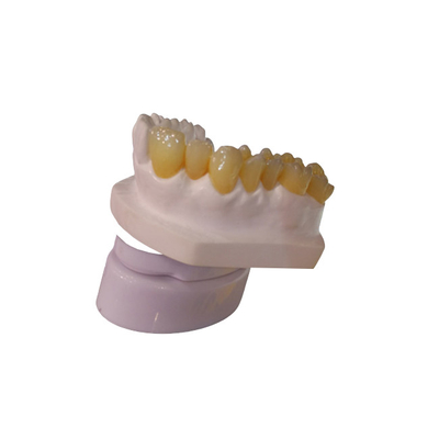 Imprimante dentaire Dental Crowns du laboratoire 3D de couronne de la conception PFM du DAO FAO
