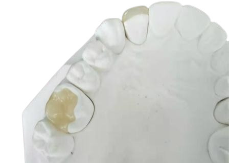 Couronne flexible durable IPS dentaire E Max Press Inlay Onlay de pont de PFM