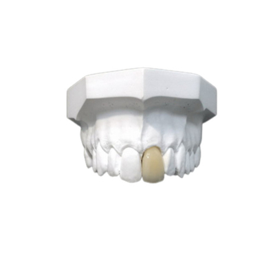 Matériel biologique de Technologie de pointe de bonne de Biocompatibility couronne dentaire de porcelaine