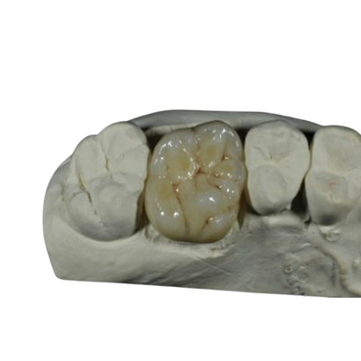 Couronne dentaire de porcelaine flexible d'OIN de la CE pour la restauration de dents arrières
