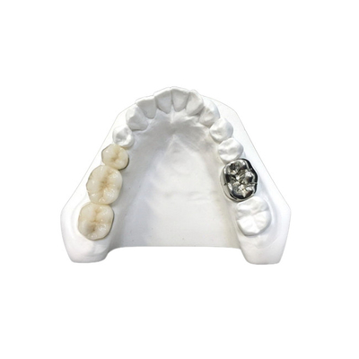Haute densité dentaire de sécurité de santé de couronne de porcelaine ultra dure de Digital