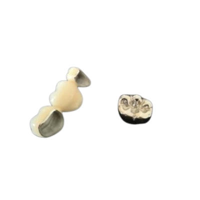 Couronne dentaire de polissage haut Intermiscibility biologique de porcelaine d'OEM