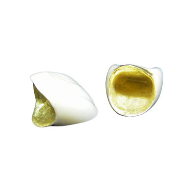 Stabilité de la couleur fondue par porcelaine forte de couronne en métal du cosmétique PFM
