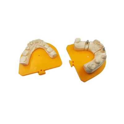 Couronne en céramique dentaire de la couronne PFM de porcelaine de haute résistance d'or jaune