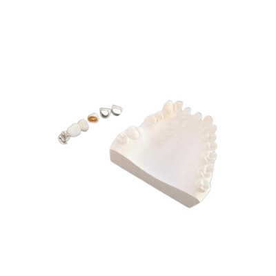 Résistance à la corrosion adaptée aux besoins du client en métal dentaire de couronne de porcelaine de PFM plein