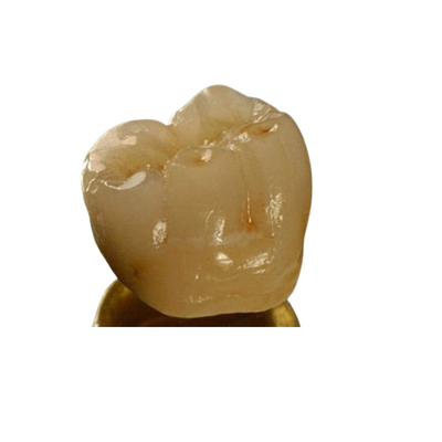 Couronne dentaire de porcelaine inter de miscibilité