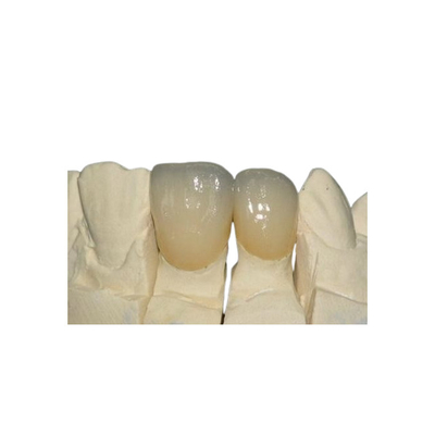 Couronne de métal céramique extérieure lisse de PFM anticorrosion
