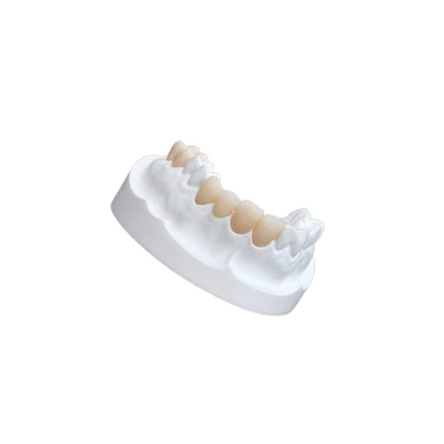 Placages composés de porcelaine d'IPS E Max Ceramic Dental Crown Comfortable