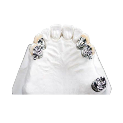 Le dentier partiel d'OEM d'attachement propre facile de précision souillent résistant