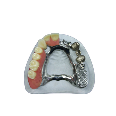 Belle apparence Précision Prêtement Prothèse Prêtement Implant