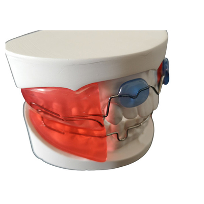 Les appareils orthodontiques dentaires simples installent le matériel biologique de technologie