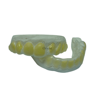 Les appareils orthodontiques de FDA sont anticorrosion et durables