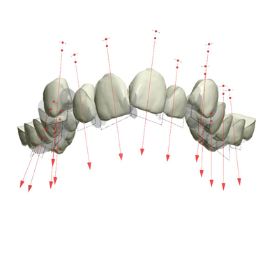 Bon Biocompatibility a fixé l'arrêtoir en caoutchouc d'appareils orthodontiques