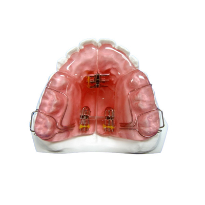L'OEM démontable fait sur commande a fixé la bonne longévité d'appareils orthodontiques