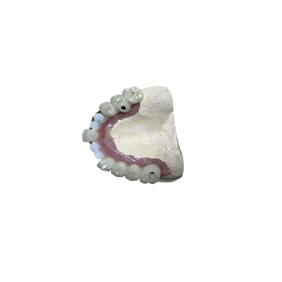 Couronne précise d'implant de dent d'attachements d'implant dentaire de Biocompatibility