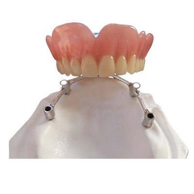 Implants dentaires de FDA de couronne d'implant de dent de COCR avec la barre titanique