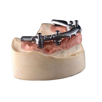 L'implant titanique de la commande numérique par ordinateur All-On-4 a fixé des dentiers pour la clinique dentaire
