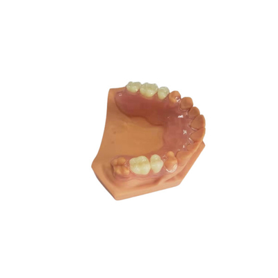 3D a imprimé des dentiers pour les laboratoires dentaires basés sur des données numériques