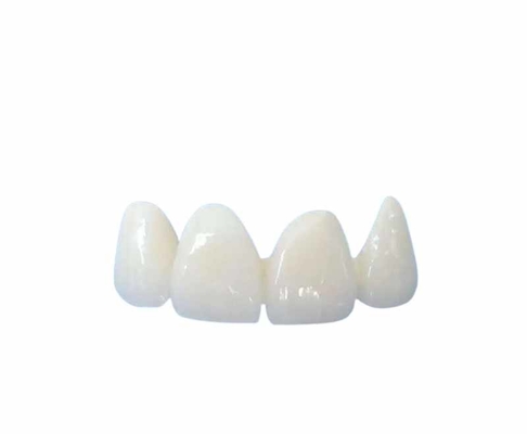 Facile nettoyant tout l'en céramique couronne la nuance naturelle transparente personnalisable