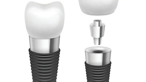Implant dentaire Rod Comfortable Highly Biocompatible Implant de chrome de titane/cobalt