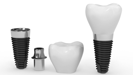 Longue barre naturelle d'implant dentaire de durée de vie d'implant artificiel fiable sûr de racine