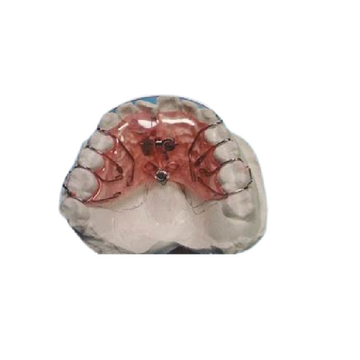 Accolades orthodontiques fixes démontables de nettoyage faciles de dispositifs d'alignement fixes sûrs