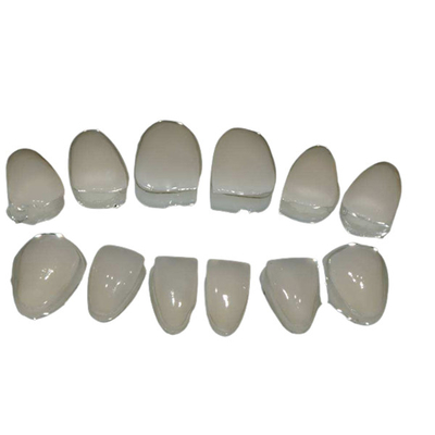 Nettoyage facile de dents en céramique de placage de personnalisation pour le sourire sûr