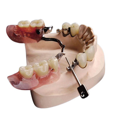 Anticorrosion naturel de dentier d'attachement de la précision Mk1 bel