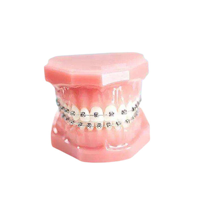 Appareil fixe durable de parenthèse orthodontique extérieure lisse en métal