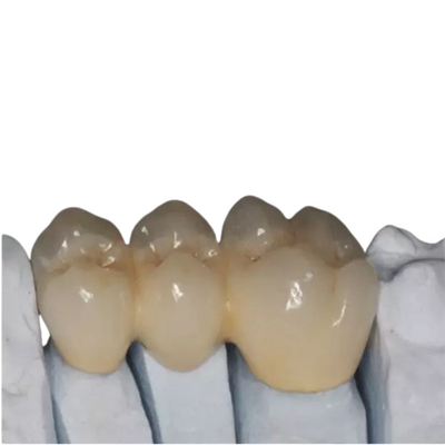 L'OEM a adapté les biens aux besoins du client de haute résistance de dents de porcelaine de zircone beaux