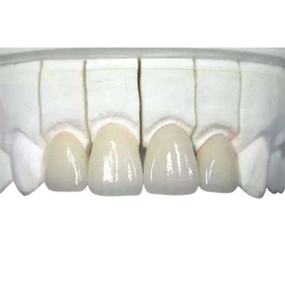 3D a imprimé biocompatible résistant à l'usure de couronne dentaire de zircone fortement