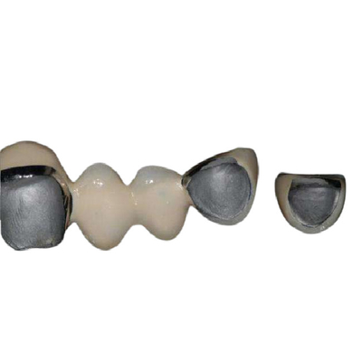 Anticorrosion superbe de cobalt de Chrome d'alliage de dents naturelles de porcelaine