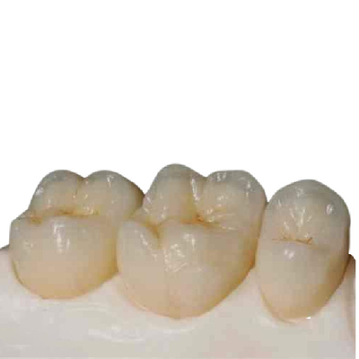Précision en céramique Digital de dents de zircone de haute résistance manufacturée