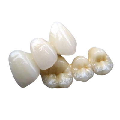 Stabilité forte de dent de couronne de pont en porcelaine aucun sensation de corps étranger