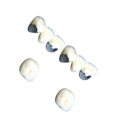 Dents dentaires de porcelaine de Chrome de cobalt de couronne de porcelaine non allergique anticorrosion