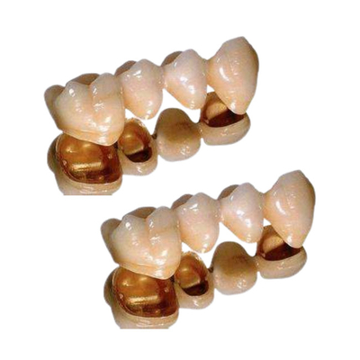 Ductilité de couronne dentaire de porcelaine de palladium excellente anticorrosion