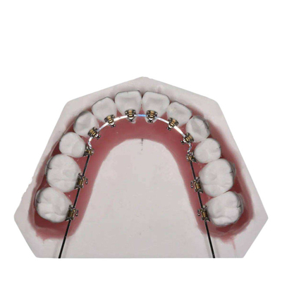 Le fil droit a fixé les appareils orthodontiques pour le redressage de dents