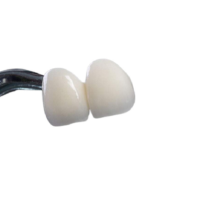 Couronne dentaire de bonne zircone de Biocompatibility irritant non le nettoyage facile