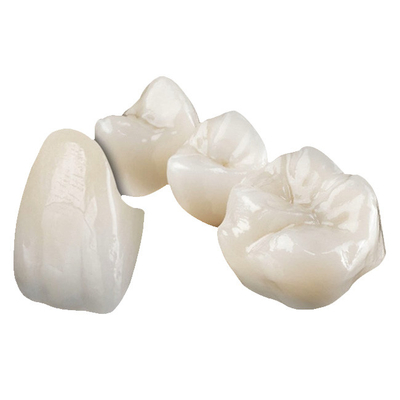 Couronne dentaire en zirconium: parfaitement ajustée, apparence naturelle