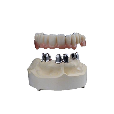 3D dentaire a imprimé la zircone couronne haut Biocompatibility résistant à l'usure