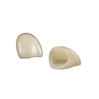 Haut laboratoire d'implant dentaire de Biocompatibility de pont dentaire démontable de forte stabilité