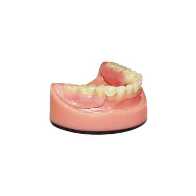 Système de balayage intraoral dentaire de représentation du pont 3D Digital d'OEM PFM